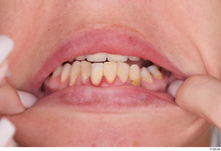 Mia Brown teeth 0003.jpg